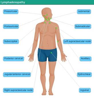 Lymphadenopathy.jpg