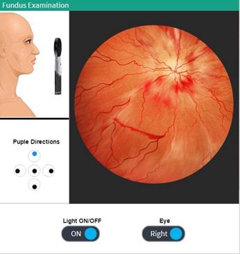 fundus.jpg