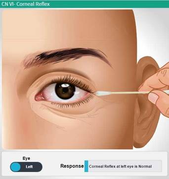 corneal reflex