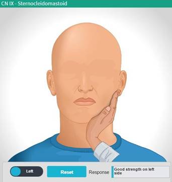 sternoclaidomastoid.jpg