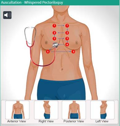 Auscultation Whispered Pectoriloquy